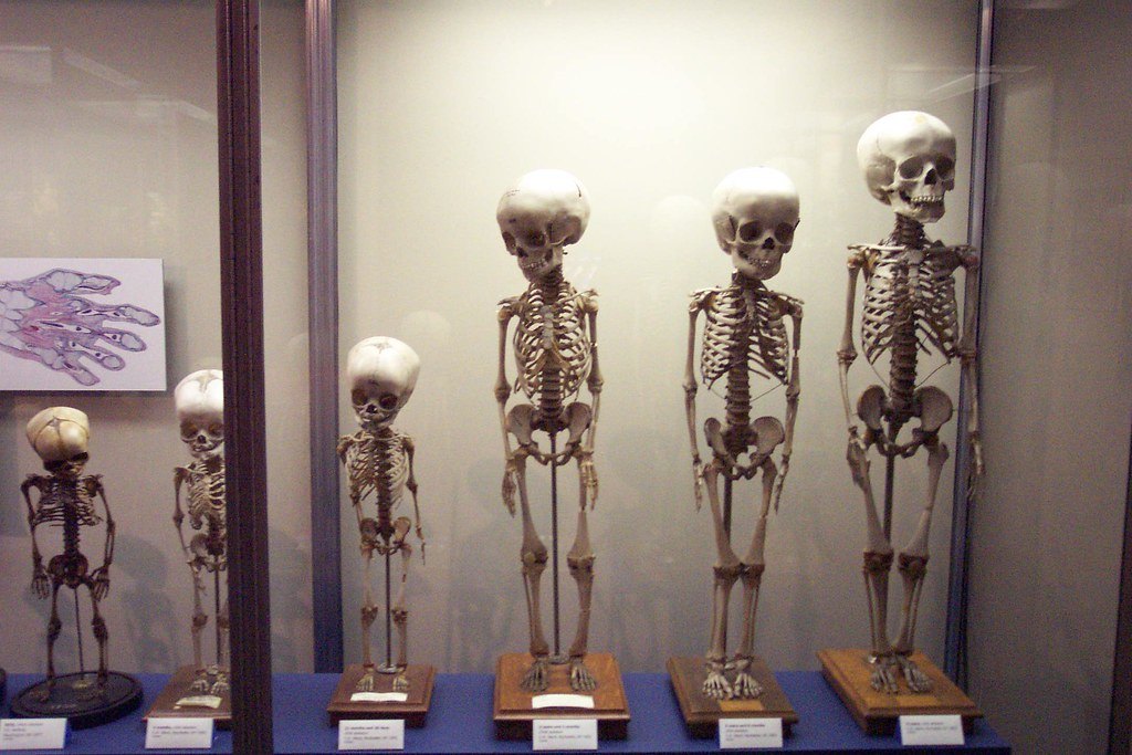 Modèles de squelettes humains illustrant l'anatomie des membres et du thorax