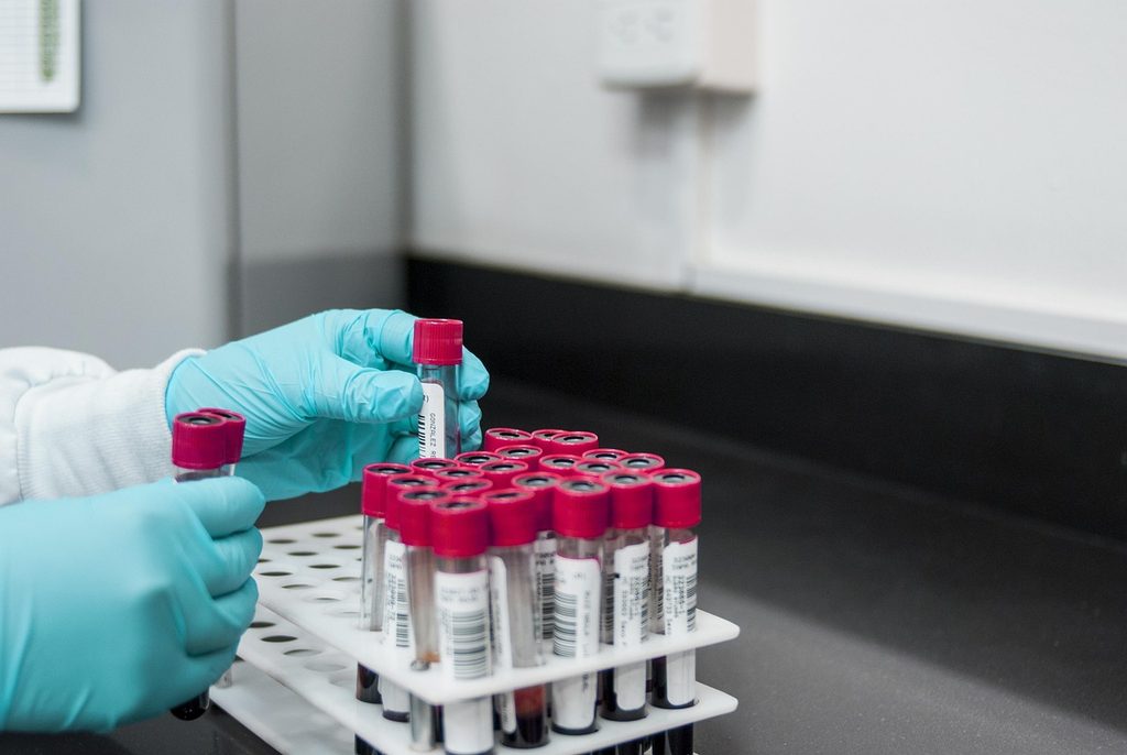 Tubes de prélèvement manipulés avec des gants dans un laboratoire